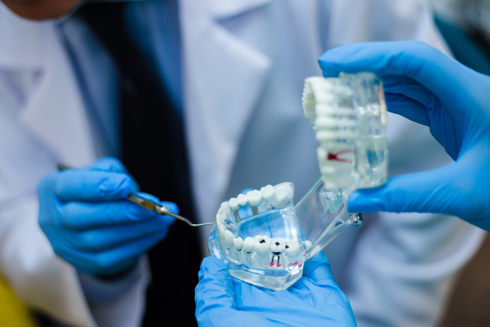 особенности внутриканального отбеливания зуба